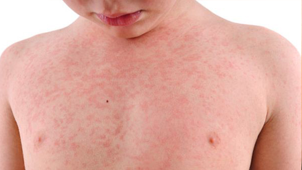 best pediatrician in dubai